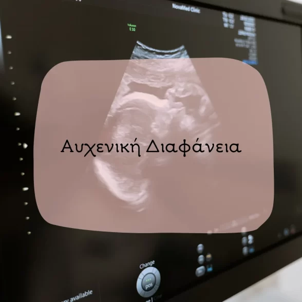 Αυχενική Διαφάνεια είναι μία υπερηχογραφική εξέταση του μωρού. Πραγματοποιείται μεταξύ 11ης και 14ης εβδομάδας κύησης κίνδυνος εμφάνισης χρωμοσωμικών ανωμαλιών του εμβρύου. Σας την κάνει ο γυναικολόγος μαιευτήρας χειρουργός Δρ. Βιδενμάγερ. Υπηρεσίες Μαιευτικές και Μαιευτικές Υπηρεσίες